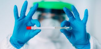 Diahuebs por spera mas di 800 caso nobo