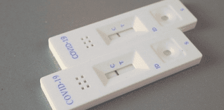 “Test bo mes y stop e transmision” Pronto COVID-19 ‘self test’ lo ta posibel na Aruba tambe