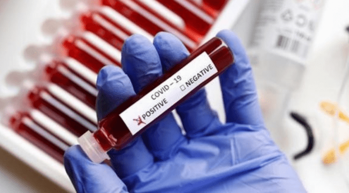 Awe dialuna a marca 19.200 caso nobo na Hulanda