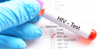 Venezolano cu malesa di HIV a gana caso den corte cu ta permiti’e keda Aruba