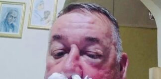 Pastor di Westpunt agredi despues di a reclama ladron