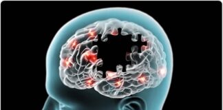 Charla informativo di Alzheimer na Centro di Bario Noord