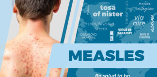 Departamento di Salud Publico trahando riba plan pa limita caso di Measles riba nos isla