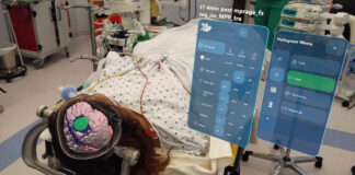 Danki na e cooperacion fructifero cu UMC Utrecht: HOH ta sigui innova uzando hololens pa operacion di celebro cu neuronabegacion