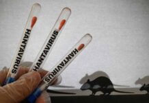 No tin motibo di preocupacion pa Aruba relaciona cu hantavirus