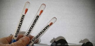 No tin motibo di preocupacion pa Aruba relaciona cu hantavirus