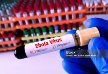 DVG ta informa: DVG ta monitor desaroyonan internacional relaciona cu Ebola