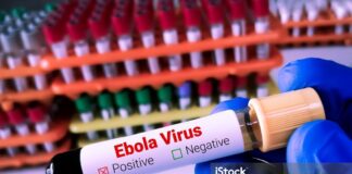 DVG ta informa: DVG ta monitor desaroyonan internacional relaciona cu Ebola