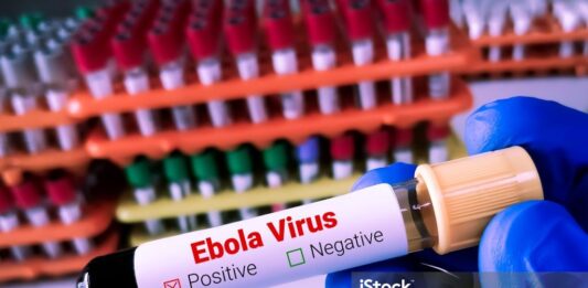 DVG ta informa: DVG ta monitor desaroyonan internacional relaciona cu Ebola